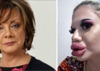 Carmen Tănase, neiertătoare cu fetele care își fac operaţiile estetice: „Toate fetele au bot de raţă şi arată la fel!“