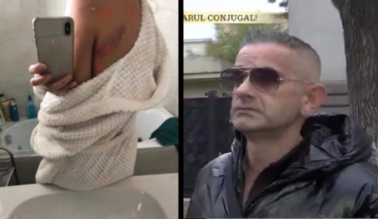Daniel Onoriu, primele declarații după ce a bătut-o pe fosta parteneră, Isabela. „Am mai înjurat-o…”
