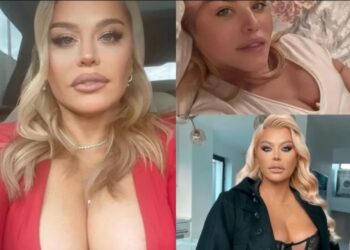 Loredana Groza: „Eu nu am apelat la nicio operație de înfrumusețare!”